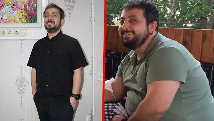 126 Kilogramdan 86 Kilograma: Mide Küçültme Ameliyatı mı Değil mi?