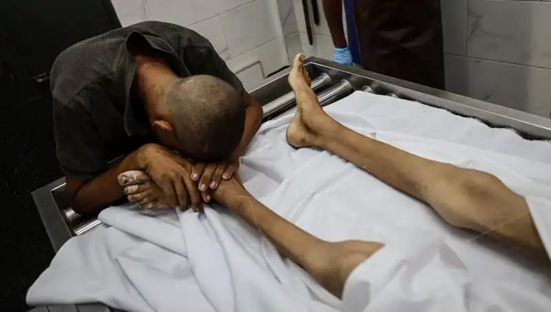 Gazze'de Açlık Felaketi: Bir Çocuk Daha Hayatını Kaybetti